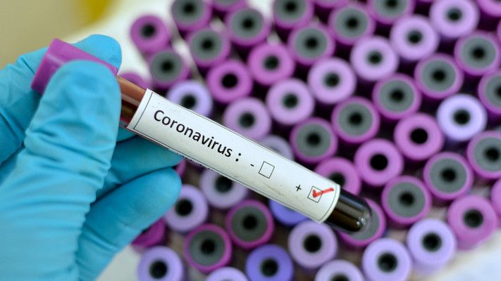 Регистрираните заразени с COVID-19 у нас са 2023