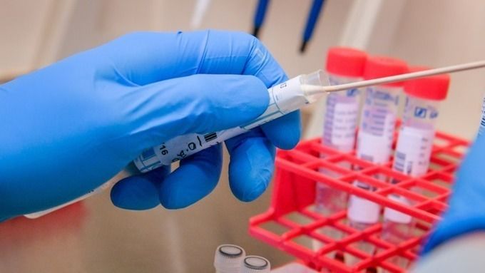 Букурещ тества за разпределението на коронавируса сред населението