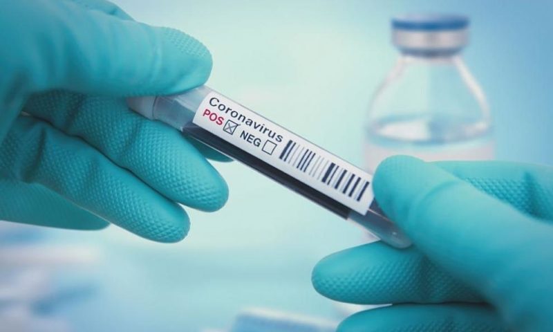 31 са новите случаи на заразени с коронавирус, общият брой вече е 2100