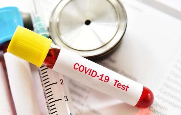 Отново ръст на заразените с коронавирус, още шестима починали