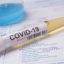 Парламентът ратифицира споразумението за ваксини срещу COVID-19