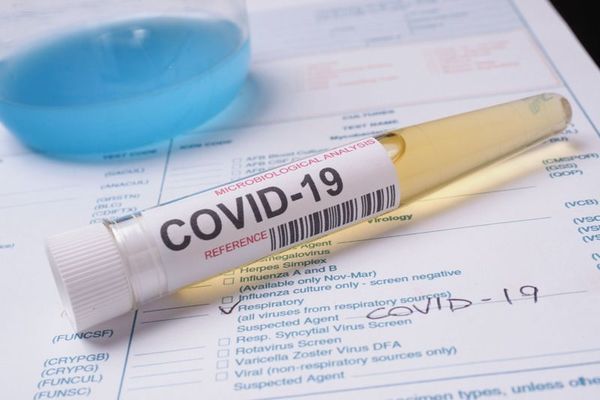 Парламентът ратифицира споразумението за ваксини срещу COVID-19