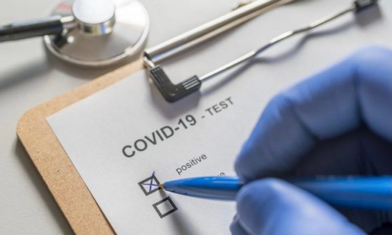 Нов странен симптом на COVID-19 у по-младите