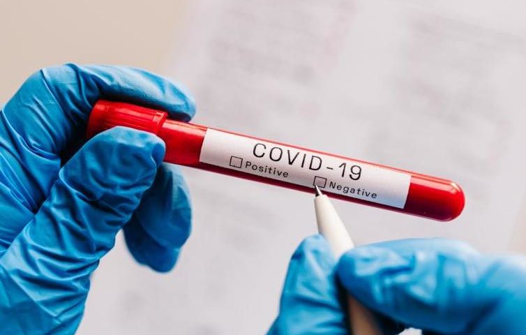 3004 нови случая на COVID-19 са потвърдени у нас през последното денонощие, 1280 са излекувани