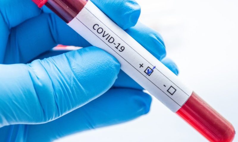 4162 нови случаи на коронавирус у нас, 115 души починаха