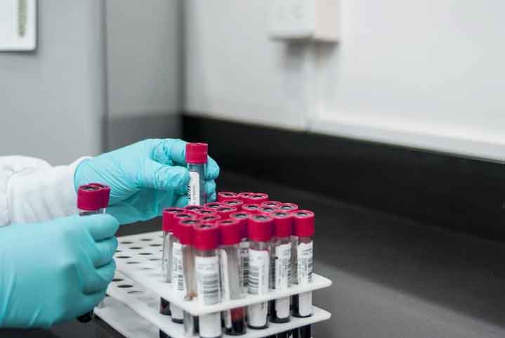 Източват държавата чрез тестове за коронавирус